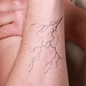 Thunderstrike Veins 1 - Temporalis